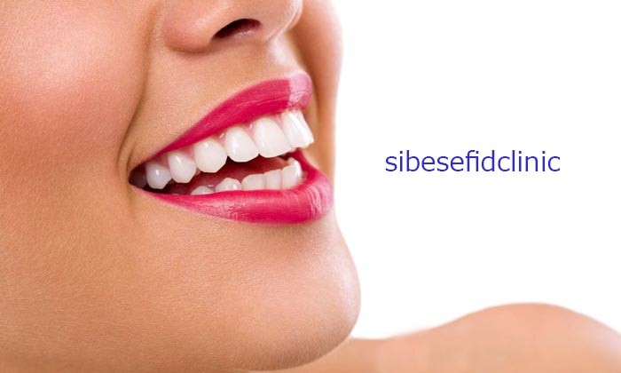 چگونه لبخندی زیبا داشته باشیم؟ قوانین داشتن لبخند زیبا و جذاب